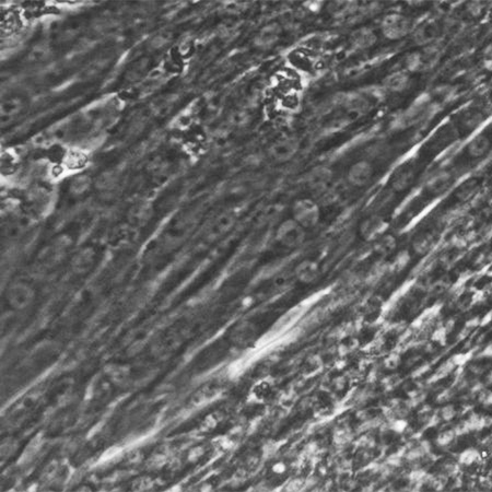 Cardiomyocyte Differentation