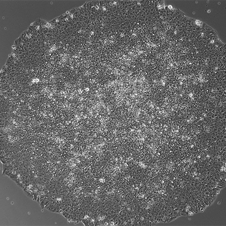 iPS Cell Reprogramming