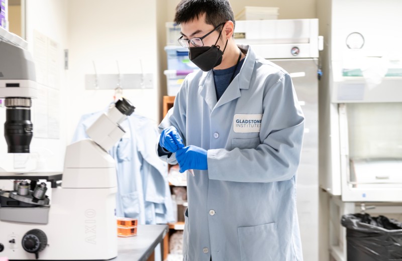 Sam Hu prepares induced pluripotent stem cells.
