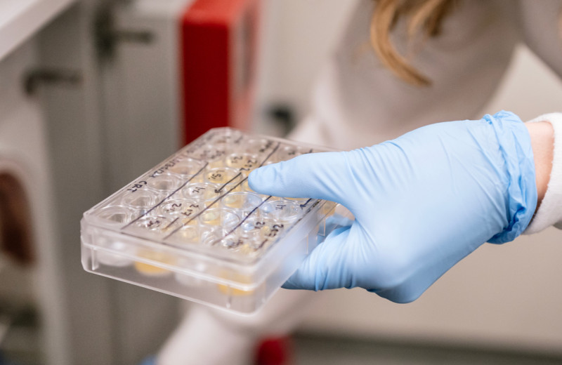 Alex Marson of Gladstone and his collaborators at Stanford University developed a genomic mapping technique that helps close the gap in understanding why certain genetic variants are tied to disease.